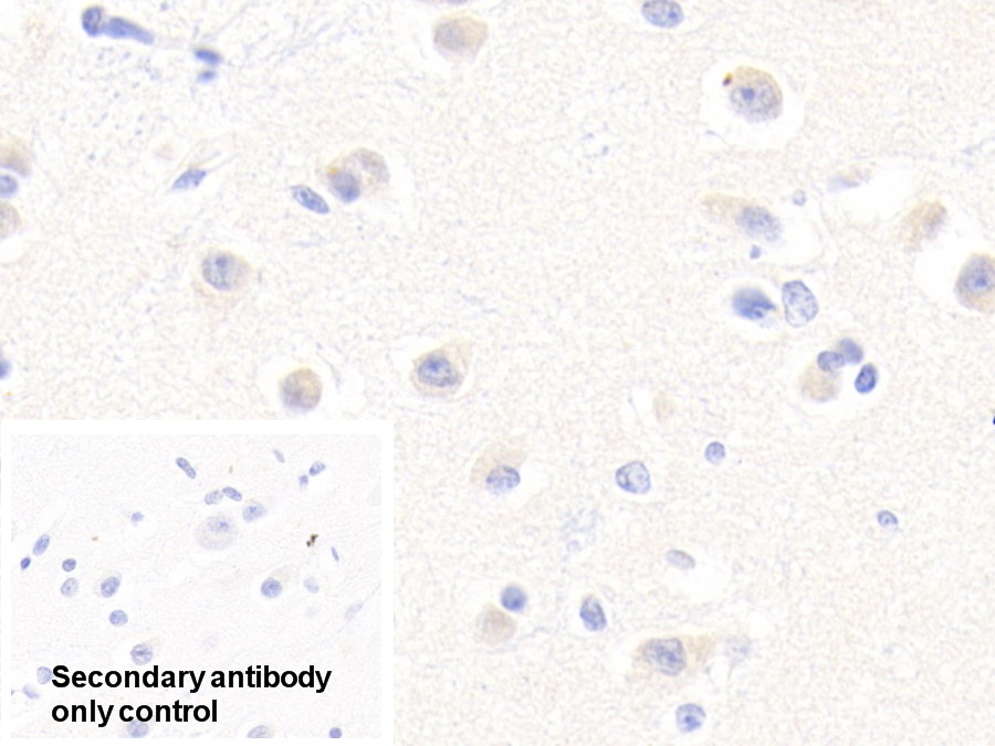 Polyclonal Antibody to Afamin (AFM)