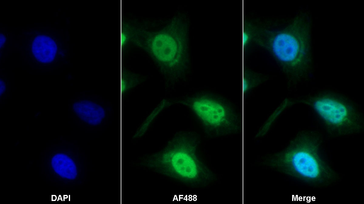 Polyclonal Antibody to Nuclear Mitotic Apparatus Protein 1 (NUMA1)