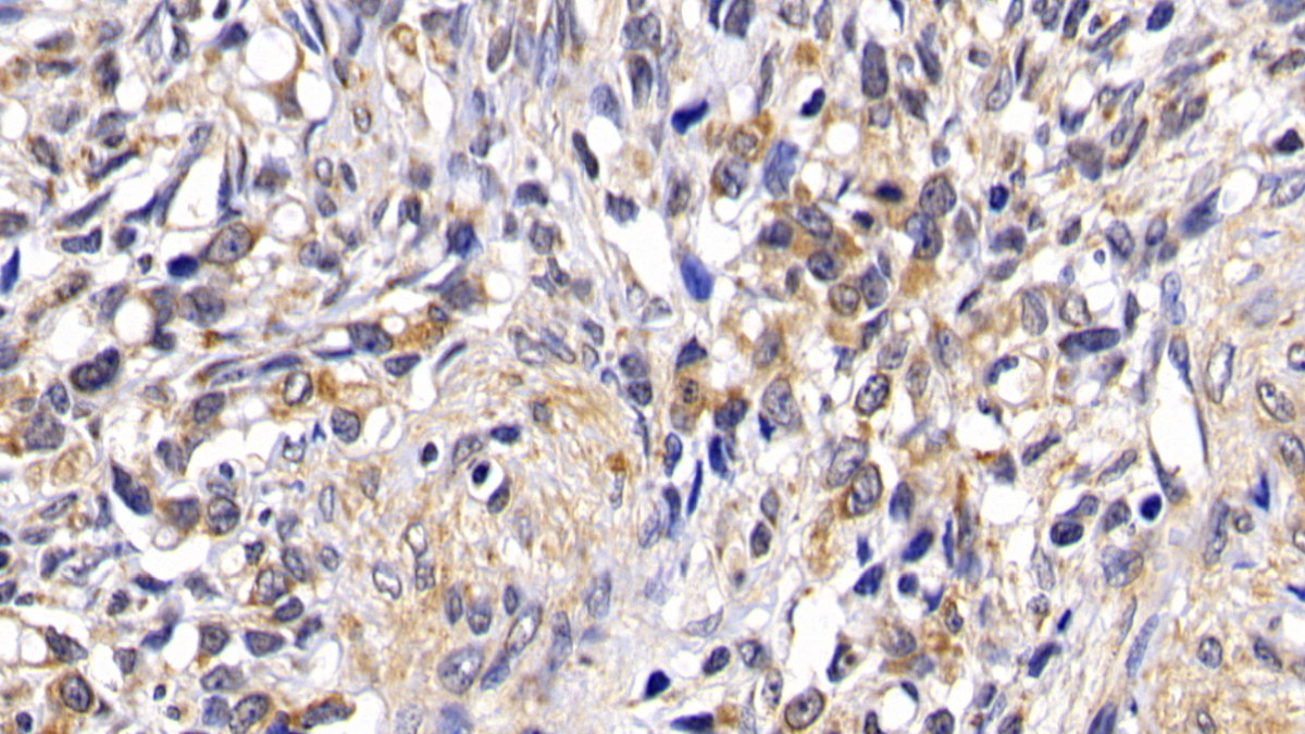Polyclonal Antibody to Bcl2 Associated Death Promoter (BAD)