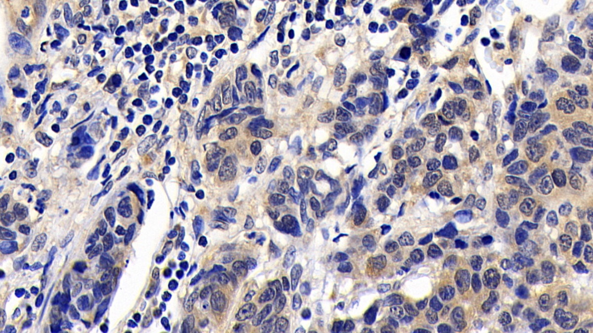 Polyclonal Antibody to Bcl2 Associated Death Promoter (BAD)
