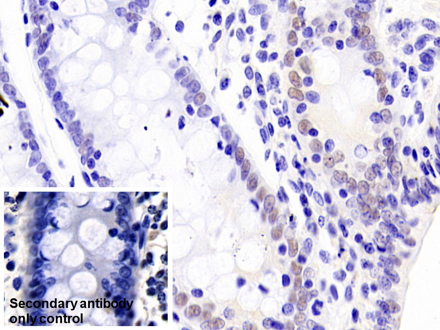 Polyclonal Antibody to Caudal Type Homeobox 2 (CDX2)