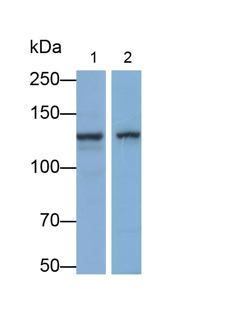 Polyclonal Antibody to Cartilage Intermediate Layer Protein (CILP)