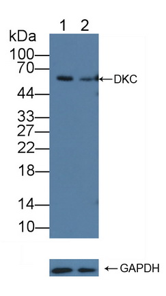 Polyclonal Antibody to Dyskerin (DKC)