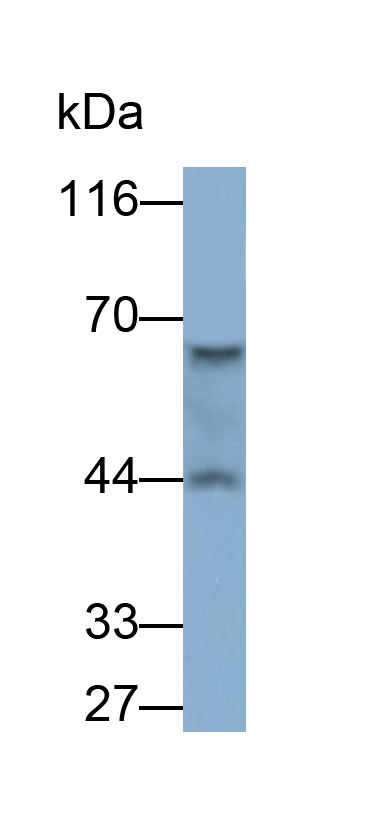 Polyclonal Antibody to Extracellular Matrix Protein 1 (ECM1)