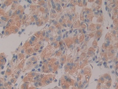 Polyclonal Antibody to Nidogen (NID)