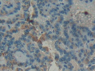 Polyclonal Antibody to Glucocerebrosidase (GBA)