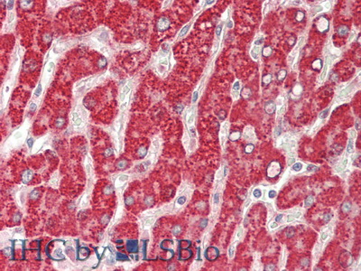 Polyclonal Antibody to Glucocerebrosidase (GBA)
