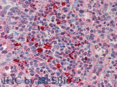 Polyclonal Antibody to Granulin (GRN)