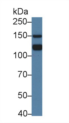 Polyclonal Antibody to Kinectin 1 (KTN1)