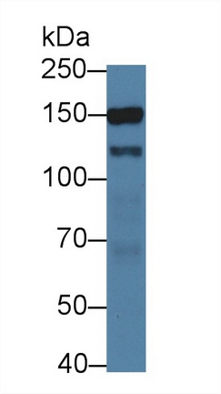 Polyclonal Antibody to Kinectin 1 (KTN1)