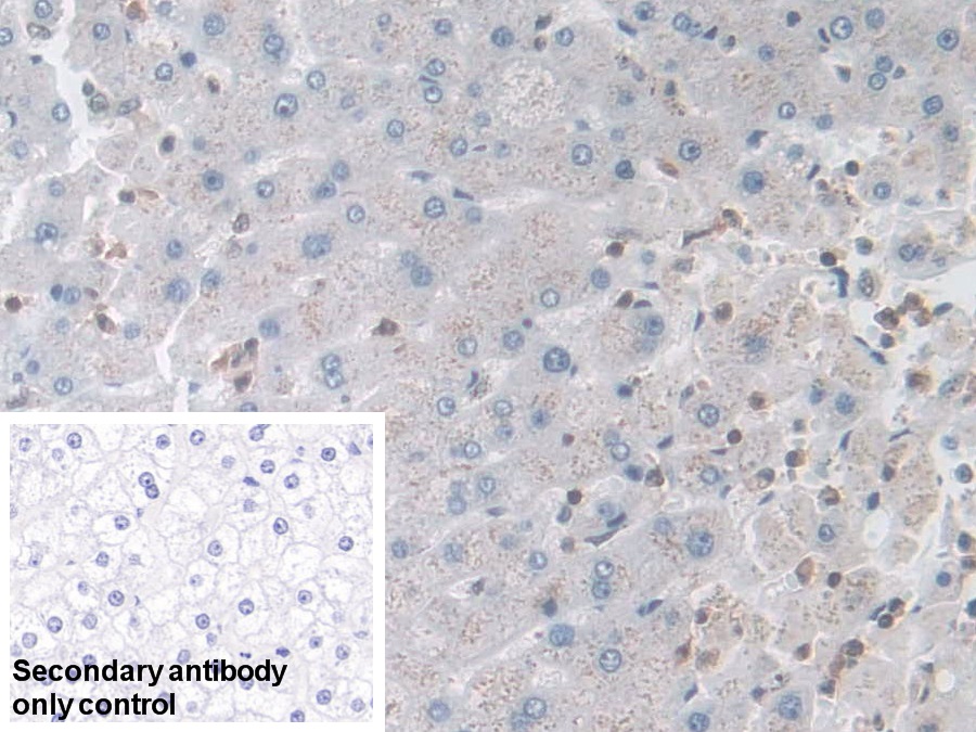 Polyclonal Antibody to L-Plastin (LCP1)