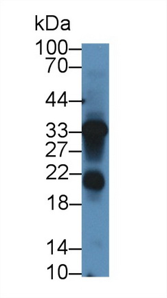 Polyclonal Antibody to Leukocyte Cell Derived Chemotaxin 1 (LECT1)
