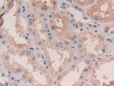 Polyclonal Antibody to Legumain (LGMN)
