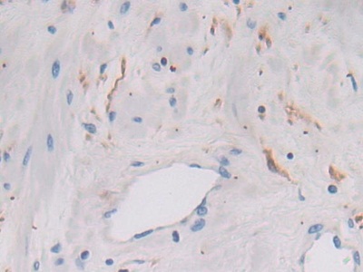 Polyclonal Antibody to Legumain (LGMN)