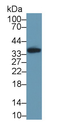 Polyclonal Antibody to Pim-1 Oncogene (PIM1)