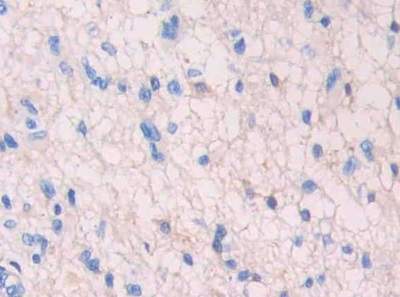 Polyclonal Antibody to Mitochondrial Uncoupling Protein 2 (UCP2)