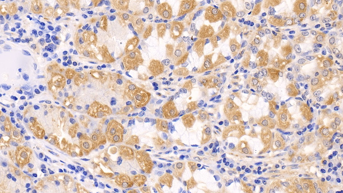 Polyclonal Antibody to Induced Myeloid Leukemia Cell Differentiation Protein Mcl-1 (MCL1)