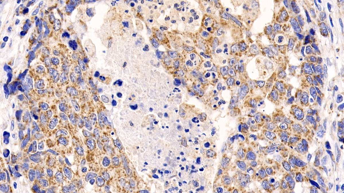 Polyclonal Antibody to Induced Myeloid Leukemia Cell Differentiation Protein Mcl-1 (MCL1)