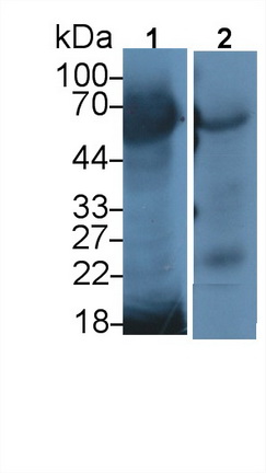 Polyclonal Antibody to Methyl CpG Binding Protein 2 (MECP2)