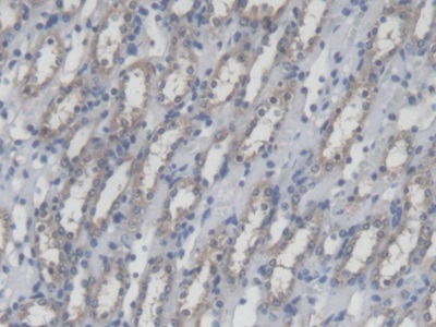 Polyclonal Antibody to Mitofusin 1 (MFN1)