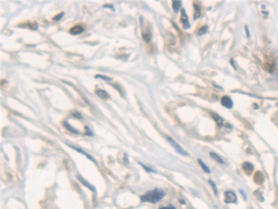 Polyclonal Antibody to N-Ethylmaleimide Sensitive Factor (NSF)