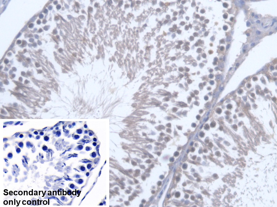 Polyclonal Antibody to Osteosarcoma Amplified 9 (OS9)