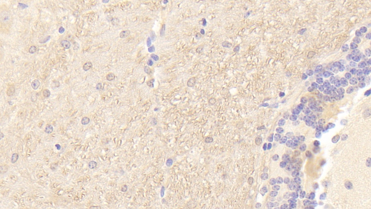 Polyclonal Antibody to Peripheral Myelin Protein 22 (PMP22)