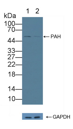 Polyclonal Antibody to Phenylalanine Hydroxylase (PAH)