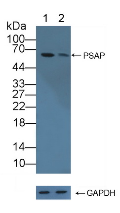 Polyclonal Antibody to Prosaposin (PSAP)