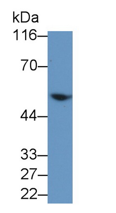 Polyclonal Antibody to Transmembrane Protease, Serine 2 (TMPRSS2)