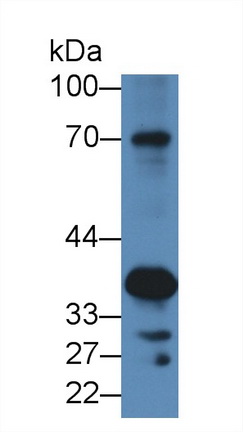 Polyclonal Antibody to Sciellin (SCEL)
