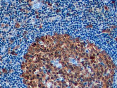Polyclonal Antibody to Stathmin 1 (STMN1)