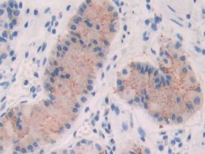 Polyclonal Antibody to Fibroblast Growth Factor 19 (FGF19)