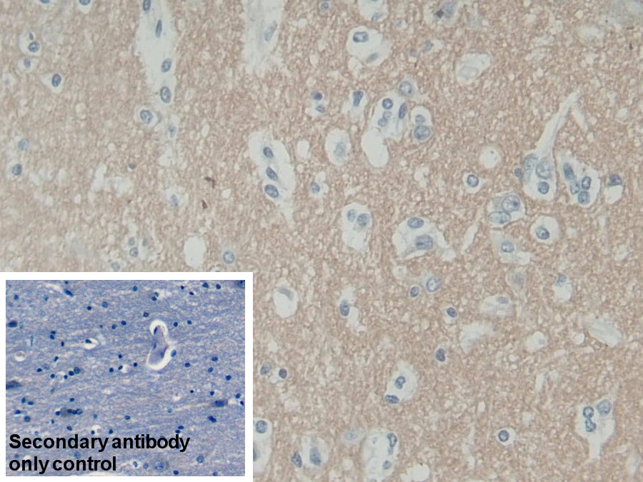 Polyclonal Antibody to Synaptosomal Associated Protein 25kDa (SNAP25)