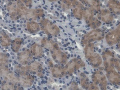 Polyclonal Antibody to Calpain 5 (CAPN5)