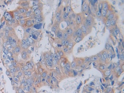 Polyclonal Antibody to Cathepsin V (CTSV)