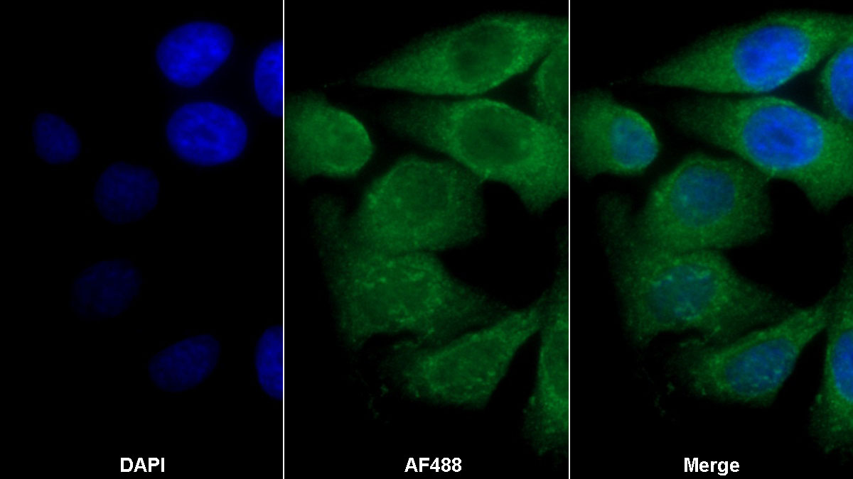 Polyclonal Antibody to Transforming Growth Factor Beta Receptor II (TGFbR2)