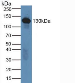 Polyclonal Antibody to Complement Component 6 (C6)