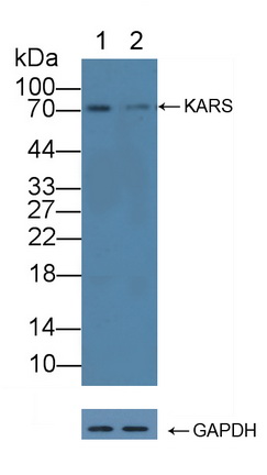 Polyclonal Antibody to Lysyl tRNA Synthetase (KARS)