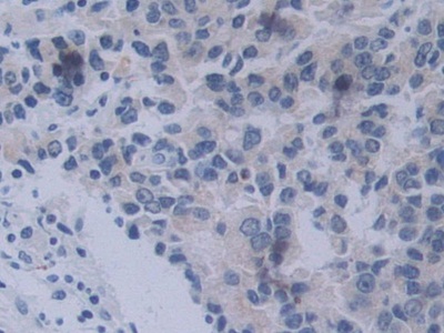Polyclonal Antibody to Neuropilin 2 (NRP2)
