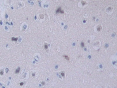 Polyclonal Antibody to Neuropilin 2 (NRP2)