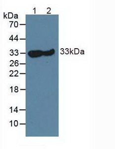 Polyclonal Antibody to Carbonic Anhydrase III, Muscle Specific (CA3)