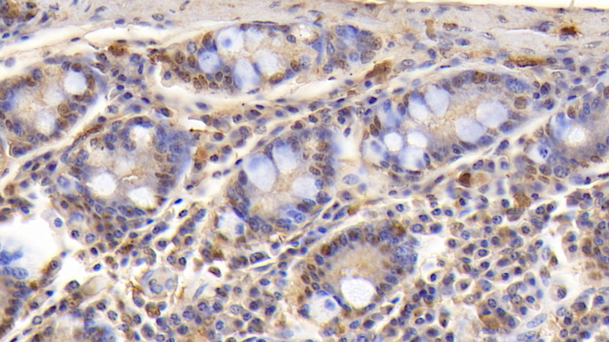 Polyclonal Antibody to T-Cell Surface Glycoprotein CD3 Epsilon (CD3e)
