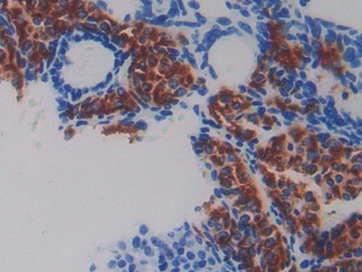Polyclonal Antibody to Fibulin 5 (FBLN5)