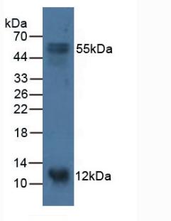 Polyclonal Antibody to S100 Calcium Binding Protein A14 (S100A14)