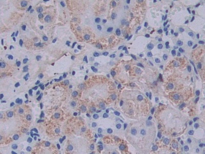 Polyclonal Antibody to Epstein Barr Virus Induced Protein 3 (EBI3)