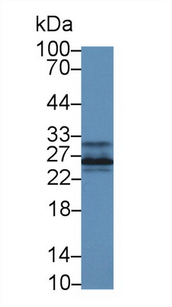 Polyclonal Antibody to Complement Component 1, Q Subcomponent A (C1qA)