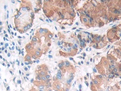 Polyclonal Antibody to Lipase, Gastric (LIPF)