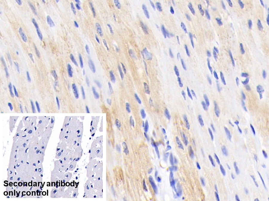 Polyclonal Antibody to Troponin T Type 2, Cardiac (TNNT2)