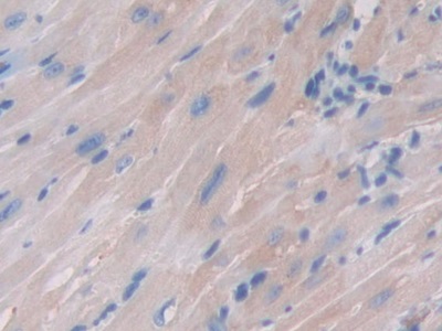 Polyclonal Antibody to Ferritin, Mitochondrial (FTMT)